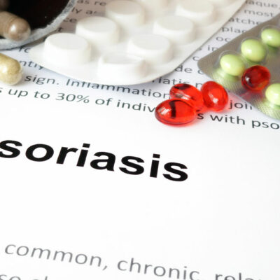 6 common health conditions related to psoriasis