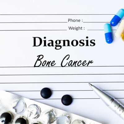 9 warning signs that indicate bone cancer